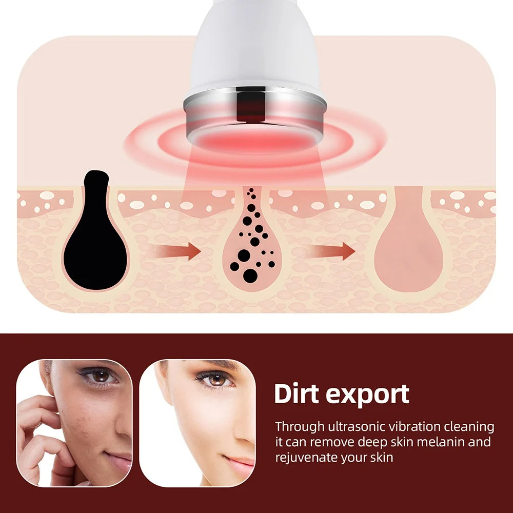 Ultrasonic Face & Eye Massager – High-Frequency Lifting & Skin Rejuvenation Beauty Device