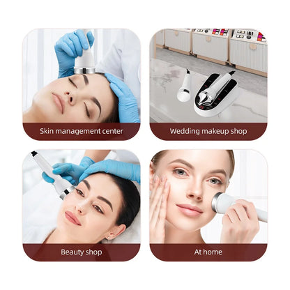 Ultrasonic Face & Eye Massager – High-Frequency Lifting & Skin Rejuvenation Beauty Device