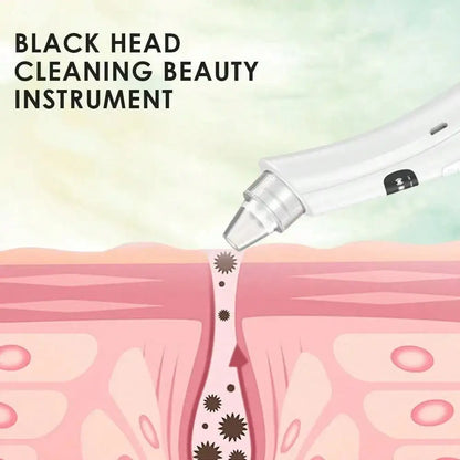 Suction Mode Face Cleansing Beauty Machine – Blackhead Remover & Dead Skin Exfoliator