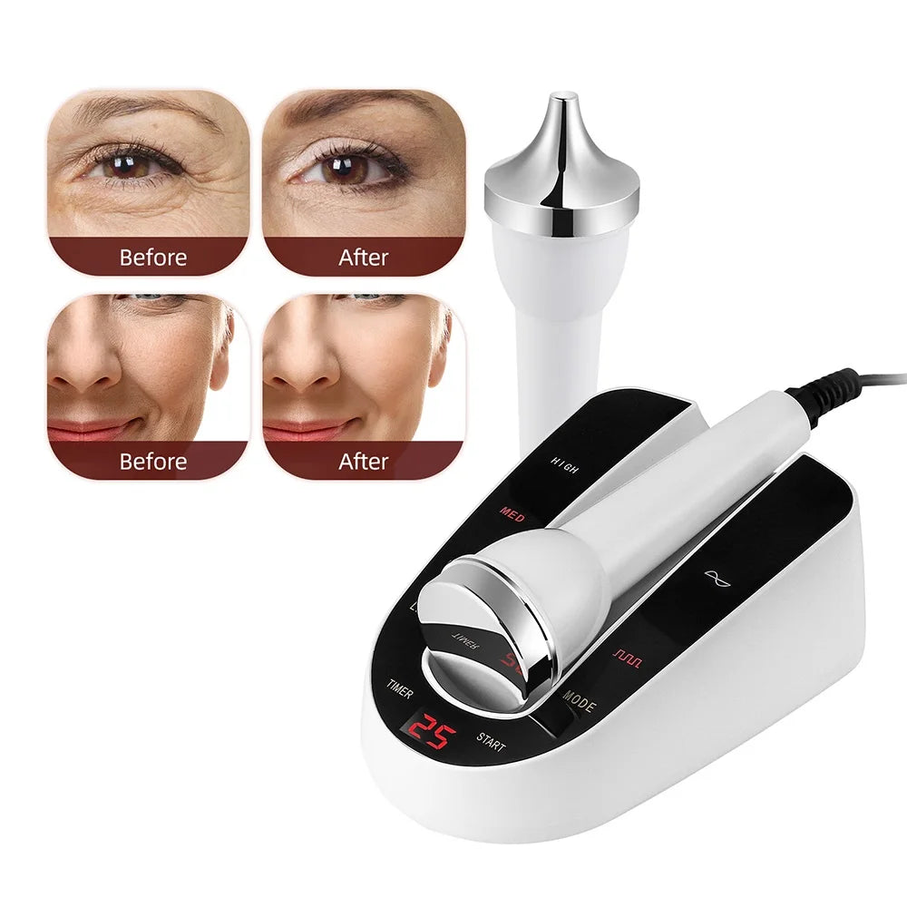 Ultrasonic Face & Eye Massager – High-Frequency Lifting & Skin Rejuvenation Beauty Device